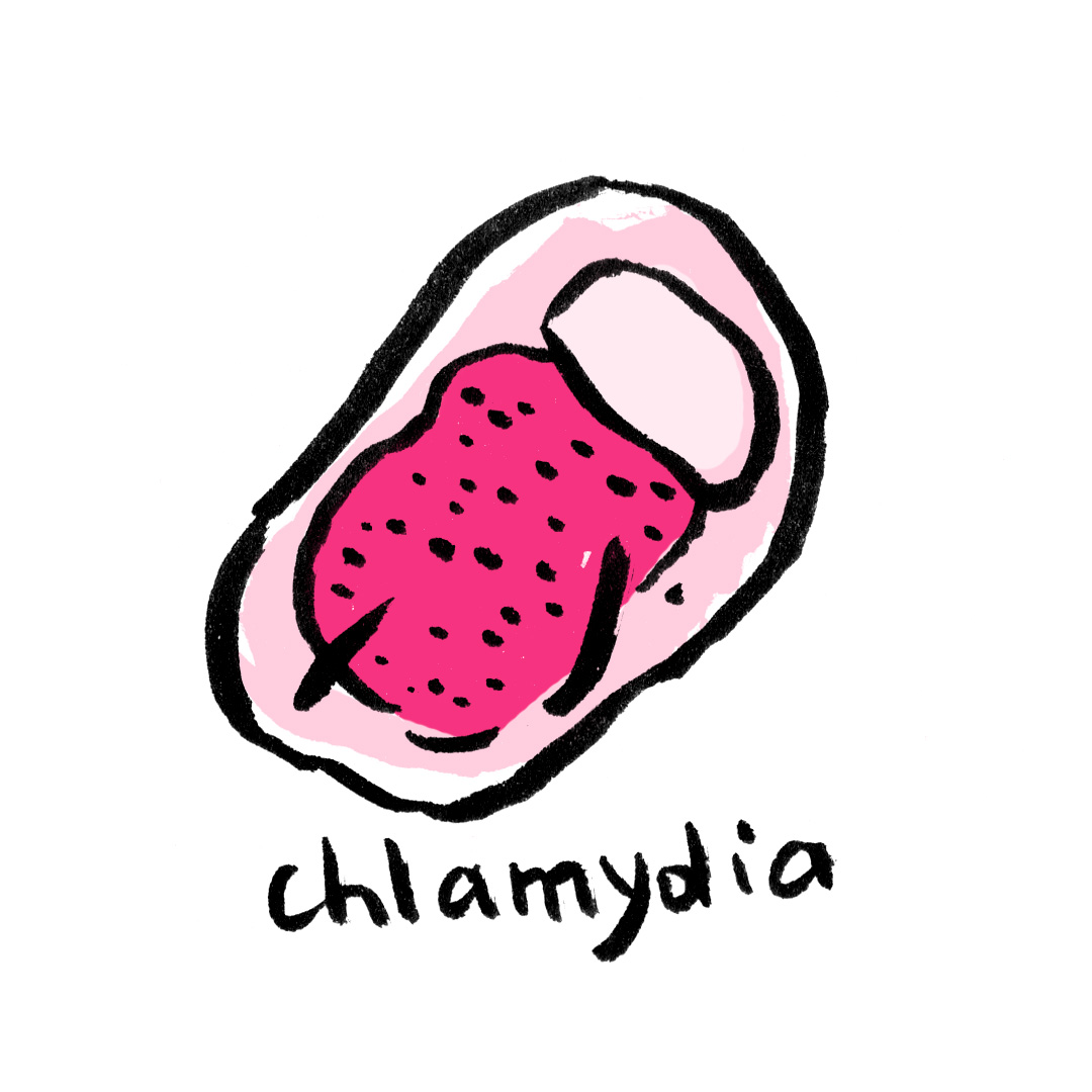 chlamydia-chlamydiose-ist-infection-transmissible